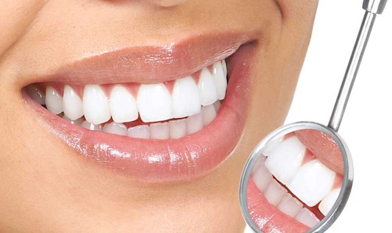 Dr. Carlos Eduardo Medici Lemos realizando procedimento de lente de contato dental em Dourados-MS