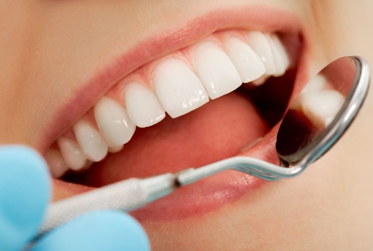 Paciente sorrindo após restauração dentária invisível feita pelo Dr. Carlos Eduardo Medici Lemos em Dourados-MS