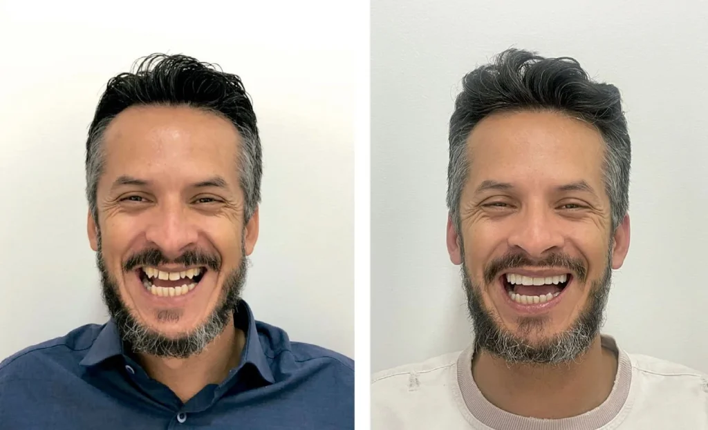 Dentista realizando avaliação para Reabilitação Oral Estética em Dourados-MS